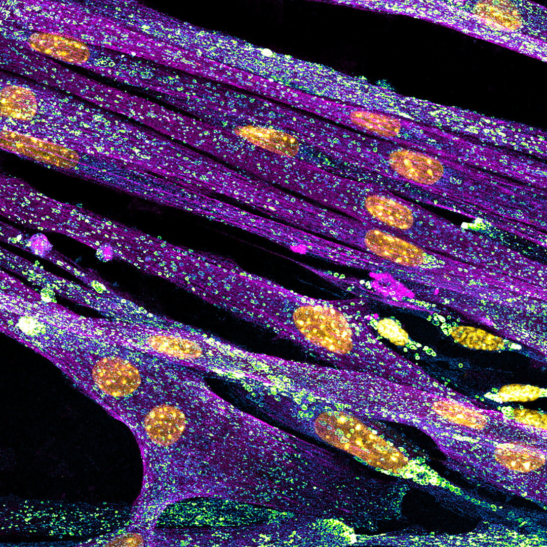 Differentiated cultured mouse myoblasts with lysosomes Nikon Small World Nadia Efimova