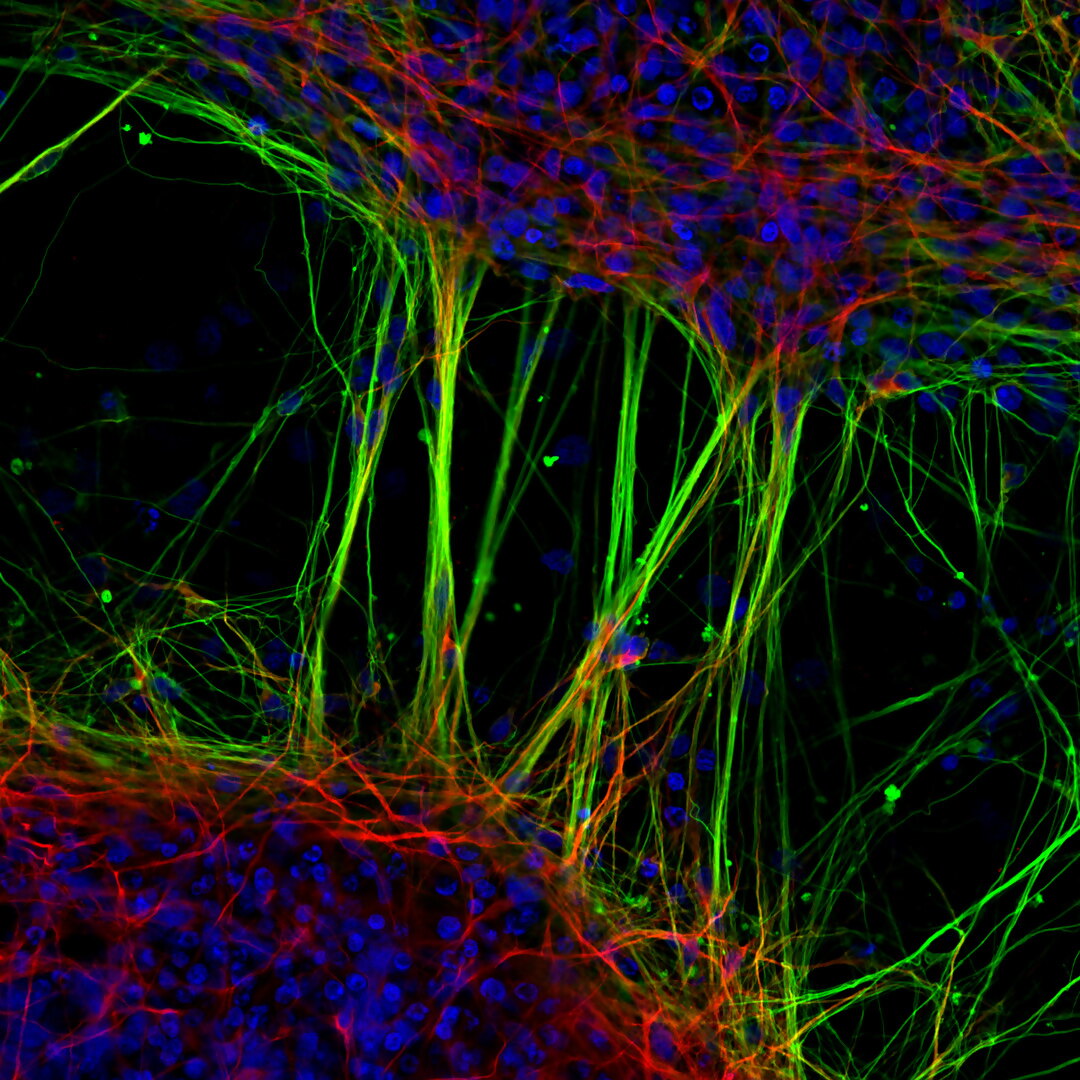 Human neurons derived from neural stem cells Nikon Small World